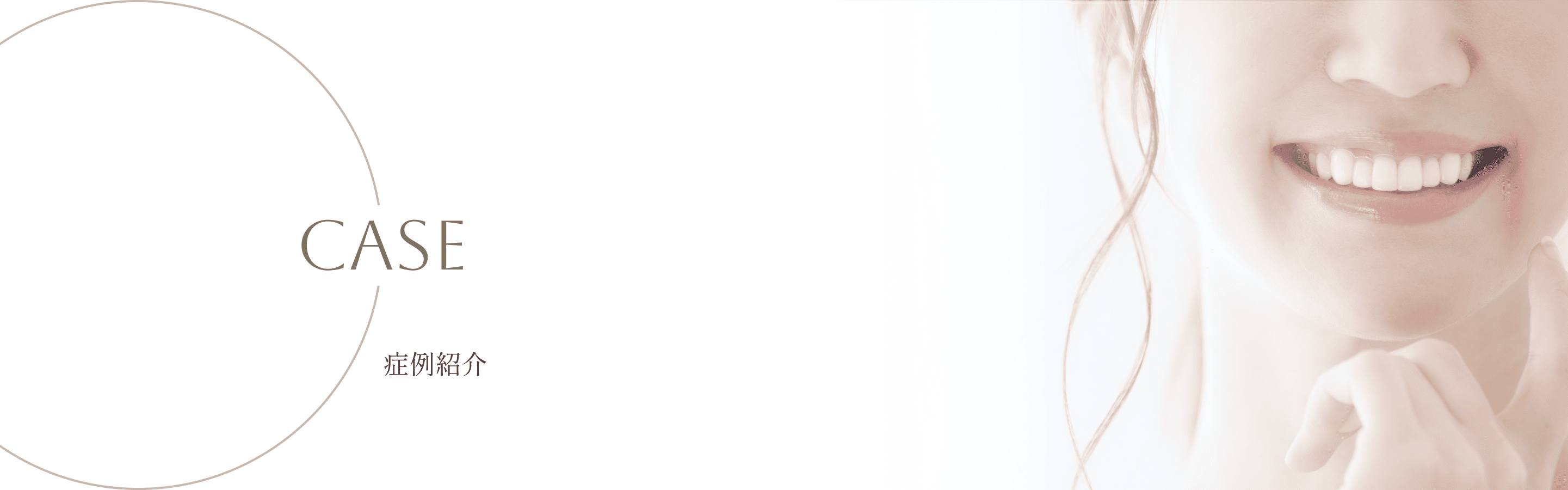 No.08　9歳1か月 女児　拡大床、前歯ワイヤー部分矯正