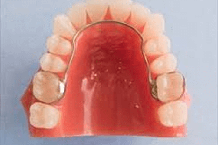 リンガルアーチ